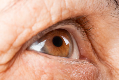¿Tipos de glaucoma?